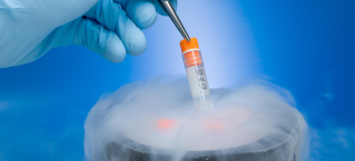 Egg Freezing: Everything You Need to Know About This Fertility Preservation Option