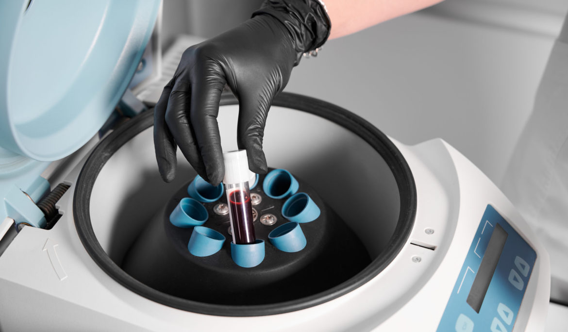 PRP Treatment Protocol in Clinical Practice: Enhancing IVF Success Rates