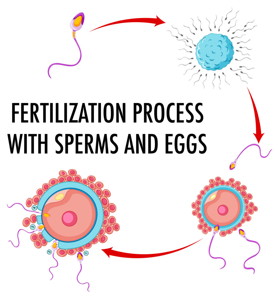 Who Needs Donor Sperm? Understanding Eligibility and Benefits